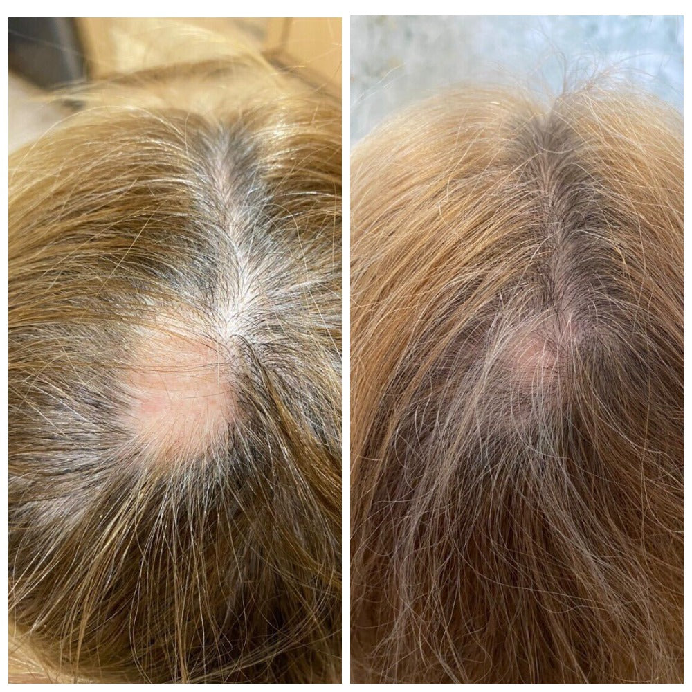 Before and after