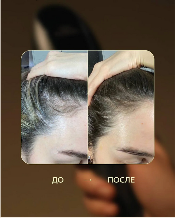Fabao (Zhangguang) 101B Hair Tonic + Electric Scalp Comb Set