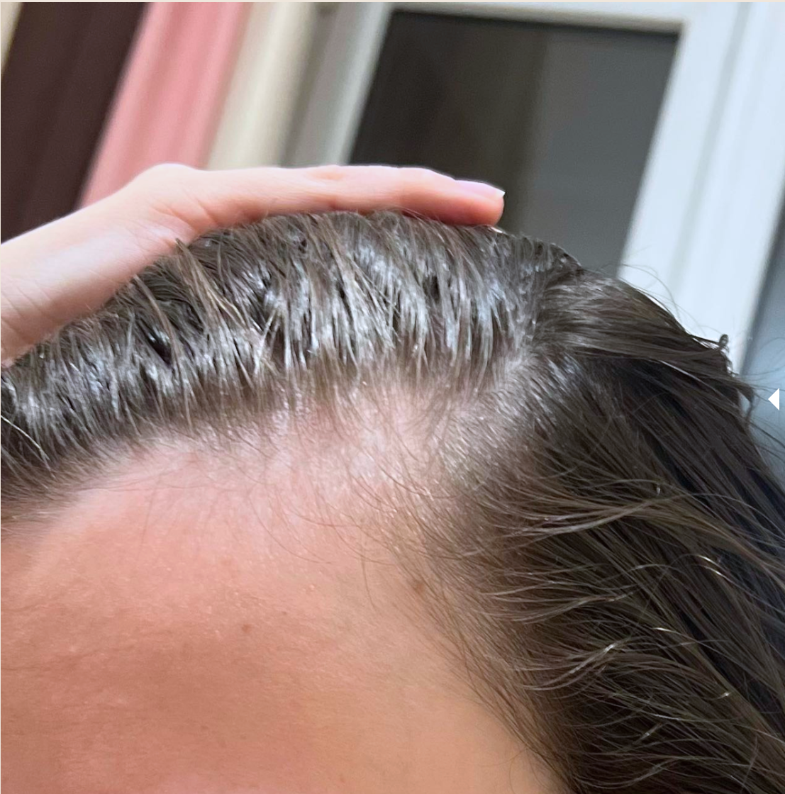 Before