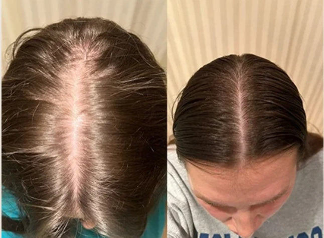 Customer-submitted Fabao before-and-after hair progress photographs, example 2