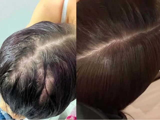 Customer-submitted Fabao before-and-after hair progress photographs, example 3