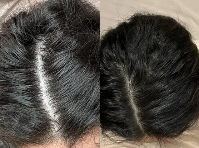 Customer-submitted Fabao before-and-after hair progress photographs, example 5